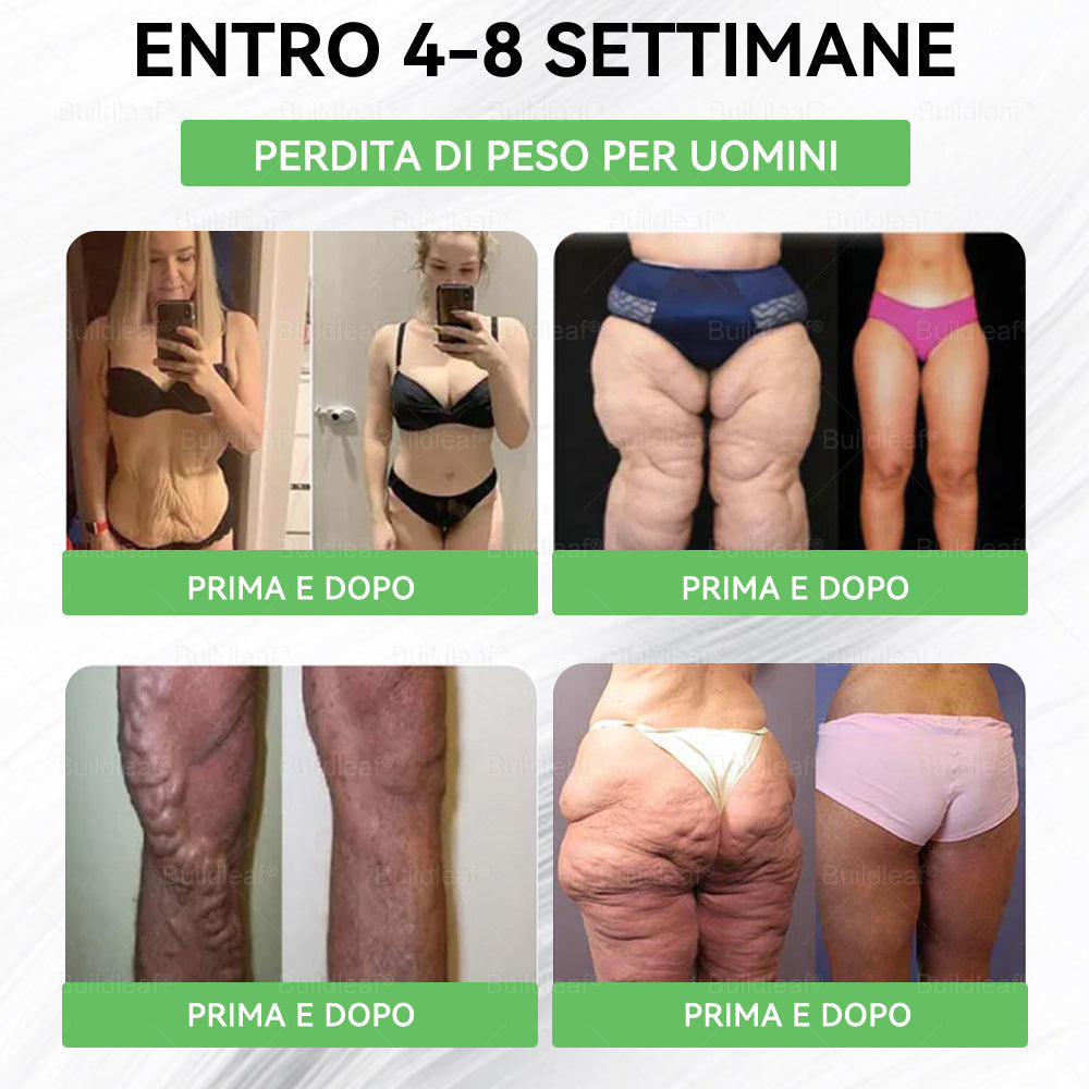 Negozio ufficiale | BuildLeaf® GLP-1 8-in-1 Fit & Vital Soluzione Orale (Solo una volta al giorno, cambiamenti visibili in 7 giorni) ✅ Per obesità, salute cardiovascolare, diabete, apnea notturna, salute intestinale, problemi articolari e altro